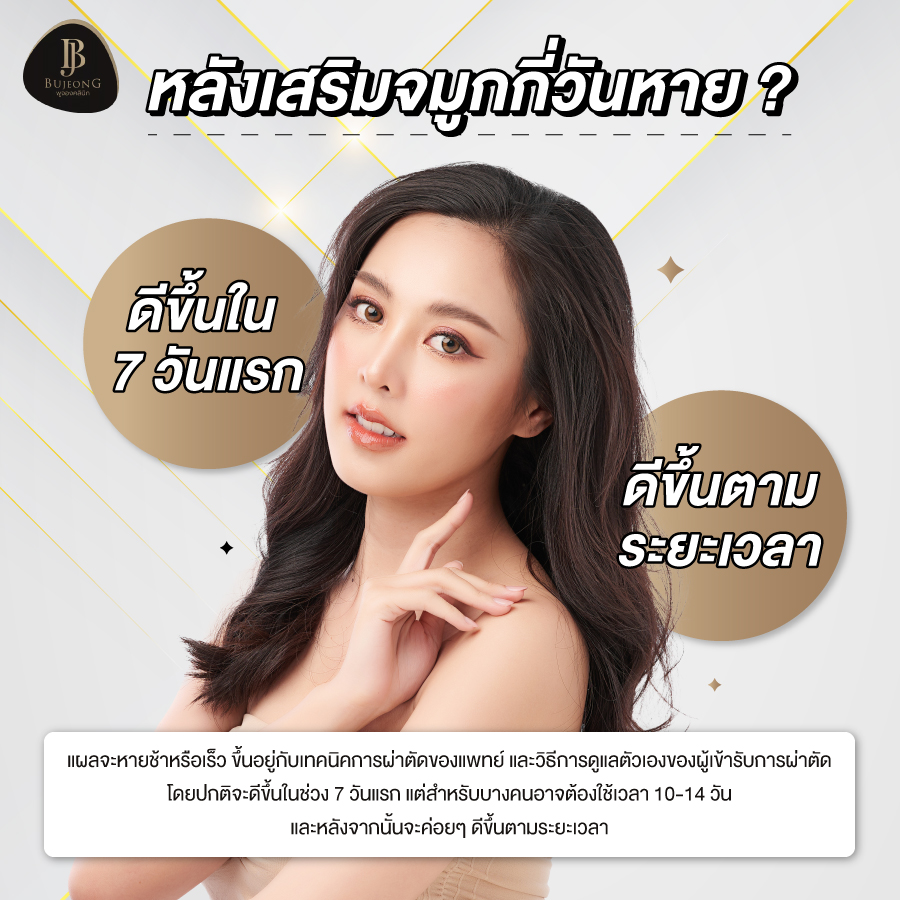 หลังเสริมจมูกกี่วันหาย ?